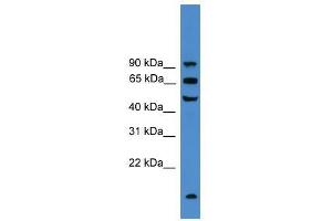 UMOD antibody used at 0. (Uromodulin antibody  (C-Term))