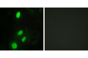 Peptide - +Western blot analysis of extracts from HeLa cells, HepG2 cells and Jurkat cells, using ETV6 antibody. (ETV6 antibody)
