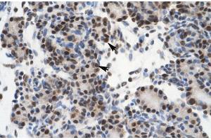 Rabbit Anti-GTF21 Antibody ,Paraffin Embedded Tissue: Human Pancreas  Cellular Data: Epithelial cells of pancreatic acinus  Antibody Concentration: 4. (GTF2I antibody  (N-Term))