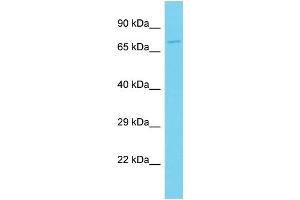 Host: Rabbit Target Name: CLEC4F Sample Type: Jurkat Whole Cell lysates Antibody Dilution: 1. (CLEC4F antibody  (C-Term))