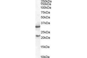 ABIN2560058 staining (2µg/ml) of mouse spleen lysate (RIPA buffer, 35µg total protein per lane).