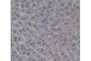 Figure. (PYGL antibody  (AA 603-750))
