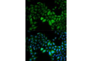 Immunofluorescence analysis of HeLa cells using TK1 antibody.