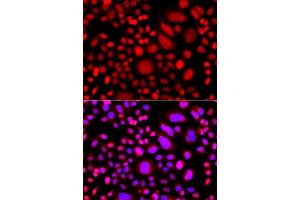 Immunofluorescence analysis of A549 cells using PRKAG3 antibody (ABIN5975719). (PRKAG3 antibody)