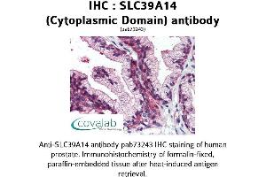 Image no. 2 for anti-Solute Carrier Family 39 (Zinc Transporter), Member 14 (SLC39A14) (Cytoplasmic Domain) antibody (ABIN1739369) (SLC39A14 antibody  (Cytoplasmic Domain))