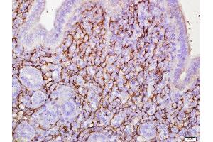 Paraformaldehyde-fixed, paraffin embedded rat uterus, Antigen retrieval by boiling in sodium citrate buffer (pH6) for 15min, Block endogenous peroxidase by 3% hydrogen peroxide for 30 minutes, Blocking buffer (normal goat serum) at 37°C for 20min, Antibody incubation with ETL/ELTD1 Polyclonal Antibody, Unconjugated  at 1:500 overnight at 4°C, followed by a conjugated secondary and DAB staining. (ELTD1 antibody  (AA 301-400))