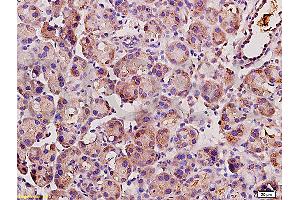 Formalin-fixed and paraffin embedded rat pancreas tissue labeled with Anti-Angiotensin II Polyclonal Antibody, unconjugated  (ABIN670521)  at 1: 200, followed by incubation with conjugated secondary antibody and DAB staining (Angiotensin II antibody)