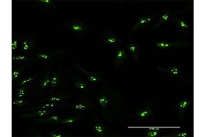 Immunofluorescence of purified MaxPab antibody to KIAA0020 on HeLa cell. (KIAA0020 antibody  (AA 1-648))