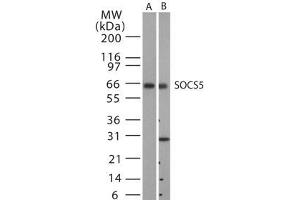 Image no. 1 for anti-Suppressor of Cytokine Signaling 5 (SOCS5) antibody (ABIN233231) (SOCS5 antibody)