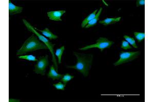 Immunofluorescence of purified MaxPab antibody to CHKA on HeLa cell. (Choline Kinase alpha antibody  (AA 1-457))