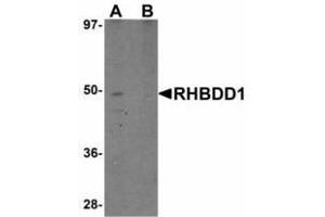 Image no. 1 for anti-Rhomboid Domain Containing 1 (RHBDD1) (C-Term) antibody (ABIN478213) (RHBDD1 antibody  (C-Term))