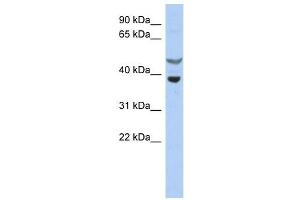 SOCS7 antibody used at 1 ug/ml to detect target protein. (SOCS7 antibody  (N-Term))