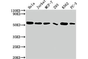Western Blot Positive WB detected in: Hela whole cell lysate, Jurkat whole cell lysate, MCF-7 whole cell lysate, 293 whole cell lysate, K562 whole cell lysate, PC-3 whole cell lysate All lanes: CDC37 antibody at 1:2000 Secondary Goat polyclonal to rabbit IgG at 1/50000 dilution Predicted band size: 45 kDa Observed band size: 50 kDa (Recombinant CDC37 antibody)
