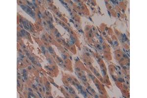 Used in DAB staining on fromalin fixed paraffin- embedded stomach tissue (ABCA9 antibody  (AA 1422-1589))