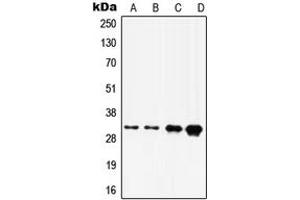 Western blot analysis of HOXD8 expression in A375 (A), A431 (B), HepG2 (C), HeLa (D) whole cell lysates.