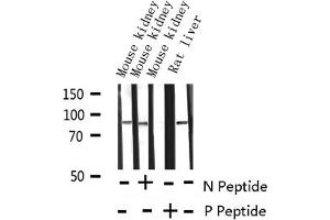 Western blot analysis of Phospho-Catenin beta (Tyr489)expression in various lysates