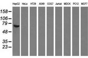Western blot analysis of extracts (35 µg) from 9 different cell lines by using anti-AFP monoclonal antibody. (alpha Fetoprotein antibody)