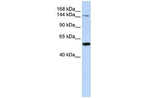EDC4 antibody used at 1 ug/ml to detect target protein. (EDC4 antibody  (N-Term))