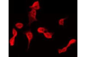 ABIN6275399 staining Hela by IF/ICC. (APOBEC3B antibody  (N-Term))