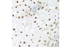 Immunohistochemistry of paraffin-embedded human esophagus using PTBP1 antibody. (PTBP1 antibody  (AA 1-100))