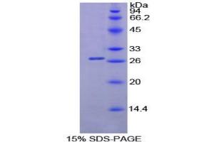 SDS-PAGE analysis of Mouse Lipase, Pancreatic Protein. (Lipase Protein)