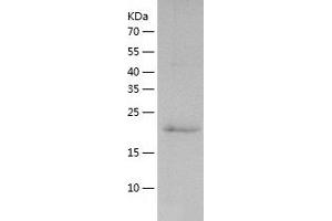 Western Blotting (WB) image for Matrix Metallopeptidase 13 (Collagenase 3) (MMP13) (AA 104-274) protein (His tag) (ABIN7286180) (MMP13 Protein (AA 104-274) (His tag))