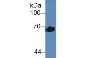 Detection of ALB in Mouse Serum using Polyclonal Antibody to Albumin (ALB) (Albumin antibody)