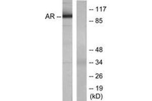 Western blot analysis of extracts from LOVO cells, using Androgen Receptor (Ab-650) Antibody.