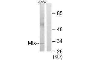 Western blot analysis of extracts from LOVO cells, using Mlx antibody. (MLX antibody)