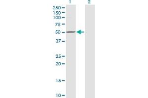 Western Blot analysis of ZMYND10 expression in transfected 293T cell line by ZMYND10 monoclonal antibody (M24), clone 3D11. (ZMYND10 antibody  (AA 341-440))