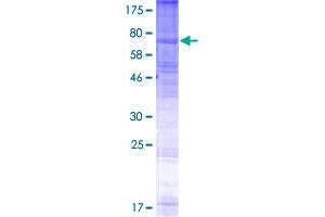 Image no. 1 for G Protein-Coupled Receptor 143 (GPR143) (AA 1-424) protein (GST tag) (ABIN1355578) (GPR143 Protein (AA 1-424) (GST tag))