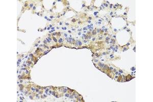 Immunohistochemistry of paraffin-embedded Mouse lung using TOMM34 Polyclonal Antibody at dilution of 1:100 (40x lens). (TOMM34 antibody)
