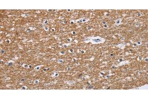 Immunohistochemistry of paraffin-embedded Human brain tissue using NCR2 Polyclonal Antibody at dilution 1:60 (NKp44/NCR2 antibody)