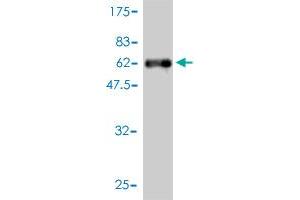Western Blotting (WB) image for anti-Small Nuclear Ribonucleoprotein Polypeptide A (SNRPA) (AA 1-282) antibody (ABIN562943)
