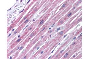 Anti-GJA5 / Connexin 40 antibody IHC of human heart. (Cx40/GJA5 antibody  (AA 86-135))