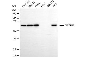 Western blotting analysis using EIF2AK2 antibody (ABIN7798508). (Recombinant EIF2AK2 antibody)