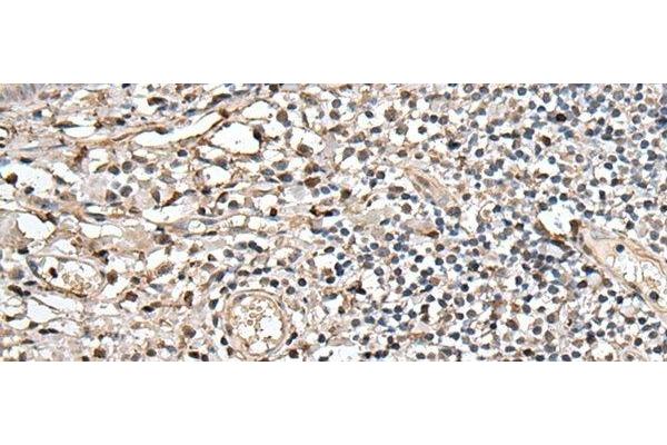 UTP3 antibody