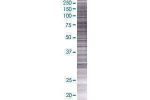 SNCAIP transfected lysate. (SNCAIP 293T Cell Transient Overexpression Lysate(Denatured))