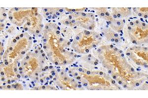 Detection of XIAP in Human Kidney Tissue using Polyclonal Antibody to X-linked Inhibitor Of Apoptosis Protein (XIAP) (XIAP antibody  (AA 1-497))