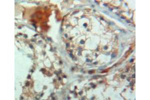 Used in DAB staining on fromalin fixed paraffin-embedded testis tissue (CRAT antibody  (AA 363-626))