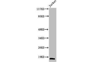 Western Blot analysis of Jurkat cells using Cleaved-Caspase-2 p18 (G170) Polyclonal Antibody (Caspase 2 antibody  (Cleaved-Gly170))