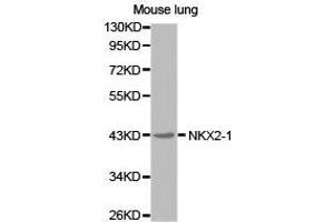 Western Blotting (WB) image for anti-NK2 Homeobox 1 (NKX2-1) antibody (ABIN1873909) (NKX2-1 antibody)