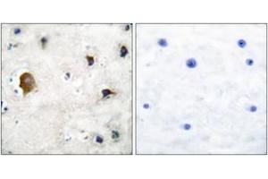 Immunohistochemistry analysis of paraffin-embedded human brain tissue, using Connexin 43 Antibody. (Connexin 43/GJA1 antibody  (AA 333-382))