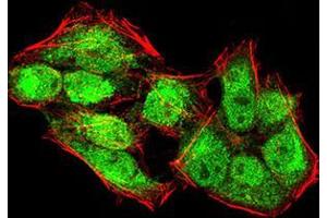 Immunofluorescence (IF) image for anti-Lysine (K)-Specific Demethylase 4A (KDM4A) (AA 932-1057) antibody (ABIN5542632)