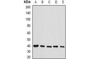 Western blot analysis of eIF3H expression in HL60 (A), HT29 (B), NIH3T3 (C), mouse testis (D), rat spleen (E) whole cell lysates. (EIF3H antibody)