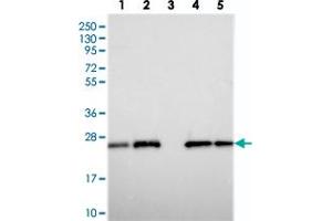 Western blot analysis of Lane 1: RT-4, Lane 2: U-251 MG, Lane 3: Human Plasma, Lane 4: Liver, Lane 5: Tonsil with C9orf142 polyclonal antibody  at 1:250-1:500 dilution. (C9orf142 antibody)