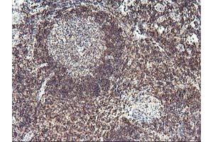 Immunohistochemistry (IHC) image for anti-PDZ and LIM Domain 2 (PDLIM2) antibody (ABIN1500130) (PDLIM2 antibody)