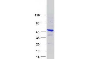 Validation with Western Blot (SYNE2 Protein (Transcript Variant 2) (Myc-DYKDDDDK Tag))