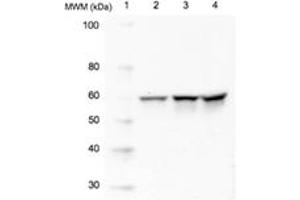 Western blot analysis of Src using 20 μg of whole cell lysate (Lane 2=HeLa, Lane 3=3T3, Lane 4=PC12) probed with with Src, mAb (5A18) at 1 μg/mL. (CSK antibody)
