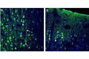 Expression of CX3CL1 in rat frontal cortex - Immunohistochemical staining of perfusion-fixed frozen rat brain sections with Anti-CX3CL1 (extracellular) Antibody (ABIN7043045, ABIN7044192 and ABIN7044193), (1:200), followed by goat anti-rabbit-AlexaFluor-488. (CX3CL1 antibody  (Extracellular))